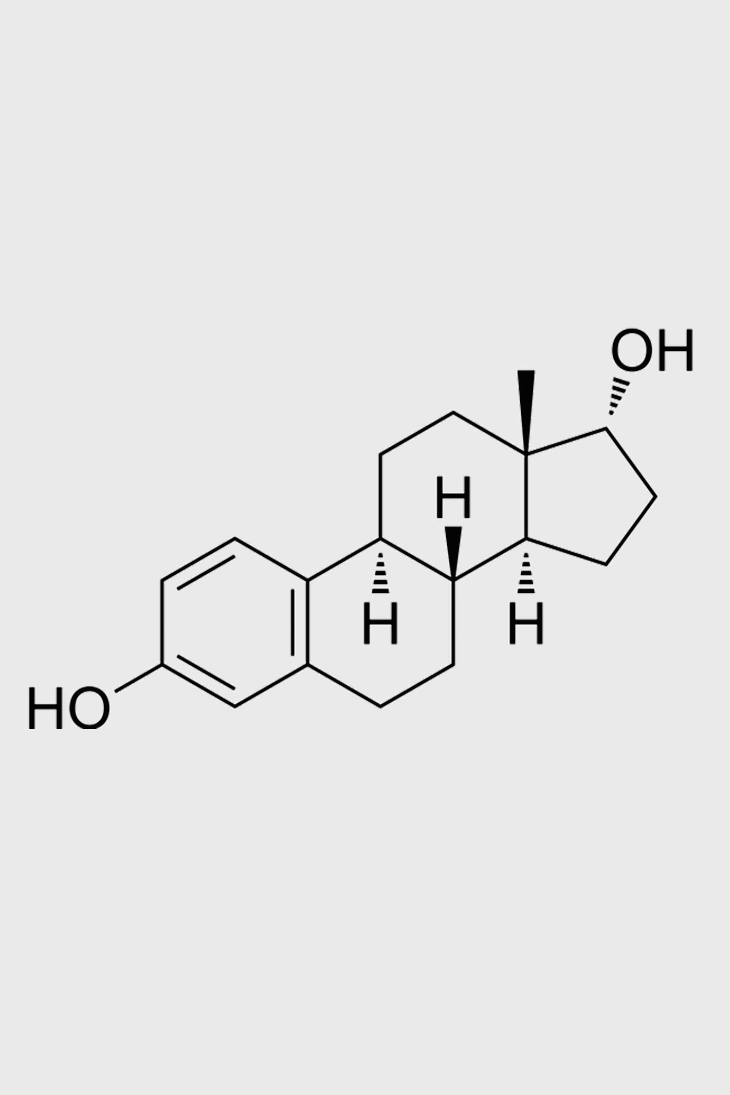 5alphareductase